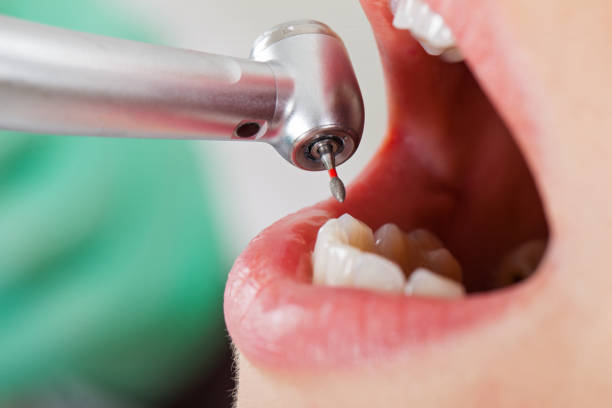 Best Emergency Dental Surgery in Tresckow, PA